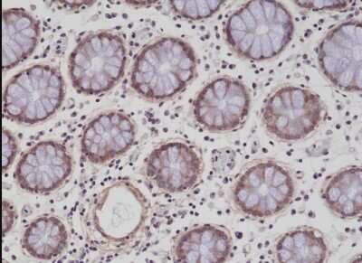 Immunohistochemistry-Paraffin: Integrin beta 1/CD29 Antibody (RM285) [NBP2-61561] - Immunohistochemical staining of formalin fixed and paraffin embedded human colon tissue sections using NBP2-61561.