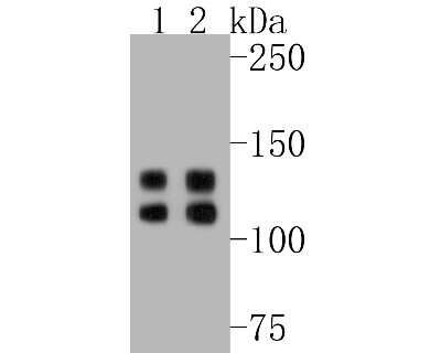 Western Blot: Integrin beta 1/CD29 Antibody (SR30-03) [NBP2-67312] - Western blot analysis of Integrin beta 1/CD29 on different lysates. Proteins were transferred to a PVDF membrane and blocked with 5% BSA in PBS for 1 hour at room temperature. The primary antibody (1/1,000) was used in 5% BSA at room temperature for 2 hou