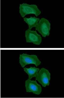 Immunocytochemistry/Immunofluorescence: Integrin beta 1D Antibody (AT47E2) [NBP2-61161] - ITGB1 in HeLa cells. The cell was stained with ATGA0485 (1:100). The secondary antibody (green) was used Alexa Fluor 488. DAPI was stained the cell nucleus (blue).