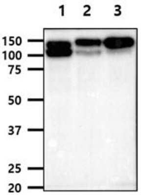 Western Blot: Integrin beta 1D Antibody (AT47E2) [NBP2-61161] - The cell lysates (40ug) were resolved by SDS-PAGE, transferred to PVDF membrane and probed with anti-human ITGB1 antibody (1:1000). Proteins were visualized using a goat anti-mouse secondary antibody conjugated to HRP and an ECL detection system.Lane 1.: A549 cell lysateLane 2.: PC3 cell lysate Lane 3.: HT1080 cell lysate