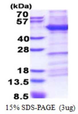 SDS-Page: Integrin beta 1D Protein [NBP2-23144]