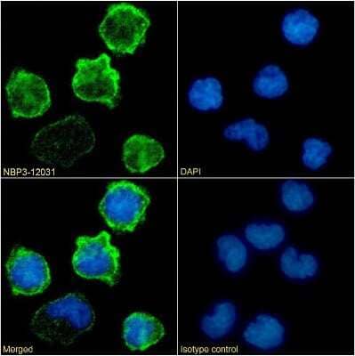 Immunocytochemistry/Immunofluorescence: Integrin beta 2/CD18 Antibody (60.3) - Chimeric [NBP3-12031] - Immunofluorescence analysis of paraformaldehyde fixed Jurkat cells on Shi-fix(TM) coverslips stained with the chimeric rabbit IgG version of 60.3 (NBP3-12031) at 10 ug/ml for 1h followed by Alexa Fluor(R) 488 secondary antibody (2 ug/ml), showing membrane staining. The nuclear stain is DAPI (blue). Panels show from left-right, top-bottom NBP3-12031, DAPI, merged channels and an isotype control. The isotype control was an unknown specificity antibody followed by staining with Alexa Fluor(R) 488 secondary antibody.