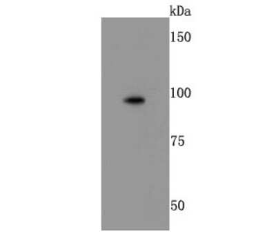 Western Blot: Integrin beta 2/CD18 Antibody (JM71-31) [NBP2-66908] - Analysis of CD18 on Jurkat cells lysates using anti-CD18 antibody at 1/500 dilution.