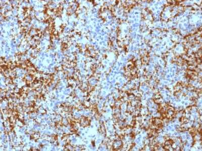 Immunohistochemistry-Paraffin: Integrin beta 3/CD61 Antibody (ITGB3/1713) [NBP2-54562] - Formalin-fixed, paraffin-embedded human Spleen stained with CD61 Monoclonal Antibody (ITGB3/1713).