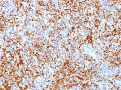 Immunohistochemistry-Paraffin: Integrin beta 3/CD61 Antibody (ITGB3/2166R) - Azide and BSA Free [NBP3-08291] - Formalin-fixed, paraffin-embedded human Spleen stained with Integrin beta 3/CD61 Rabbit Recombinant Monoclonal Antibody (ITGB3/2166R).