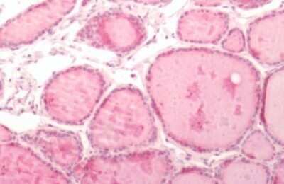 Immunohistochemistry-Paraffin: Integrin beta 3/CD61 Antibody [NB110-55536] - Human Thyroid: Formalin-Fixed, Paraffin-Embedded (FFPE)