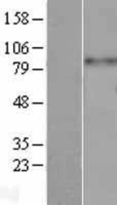 Western Blot: Integrin beta 3 Overexpression Lysate (Adult Normal) [NBL1-12073] Left-Empty vector transfected control cell lysate (HEK293 cell lysate); Right -Over-expression Lysate for Integrin beta 3.