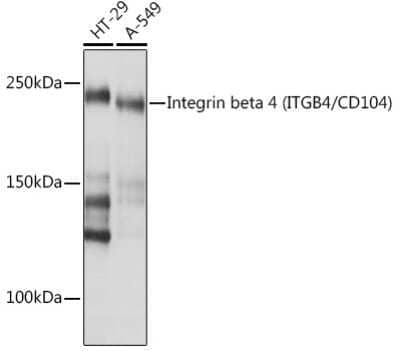 Western Blot: Integrin beta 4/CD104 Antibody (5Z9P3) [NBP3-16446] - Western blot analysis of extracts of various cell lines, using Integrin beta 4/CD104 (ITGB4/CD104) Rabbit mAb (NBP3-16446) at 1:1000 dilution. Secondary antibody: HRP Goat Anti-Rabbit IgG (H+L) at 1:10000 dilution. Lysates/proteins: 25ug per lane. Blocking buffer: 3% nonfat dry milk in TBST. Detection: ECL Basic Kit. Exposure time: 10s.