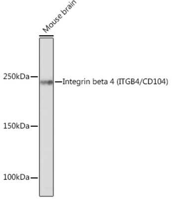 Western Blot: Integrin beta 4/CD104 Antibody (5Z9P3) [NBP3-16446] - Western blot analysis of extracts of Mouse brain, using Integrin beta 4/CD104 (ITGB4/CD104) Rabbit mAb (NBP3-16446) at 1:500 dilution. Secondary antibody: HRP Goat Anti-Rabbit IgG (H+L) at 1:10000 dilution. Lysates/proteins: 25ug per lane. Blocking buffer: 3% nonfat dry milk in TBST. Detection: ECL Enhanced Kit. Exposure time: 3min.