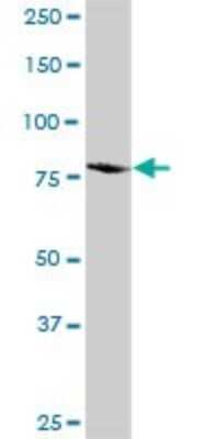 Western Blot: Integrin beta 5 Antibody [H00003693-D01P] - Analysis of ITGB5 expression in mouse kidney.
