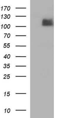 Western Blot: Integrin beta 6 Antibody (1D2) [NBP2-45462] - Analysis of HEK293T cells were transfected with the pCMV6-ENTRY control (Left lane) or pCMV6-ENTRY Integrin beta 6.