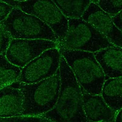Immunocytochemistry/Immunofluorescence: Integrin beta 6 Antibody [NBP2-14136] - Staining of human cell line RT4 shows localization to nucleoplasm & cell junctions. Antibody staining is shown in green. 
