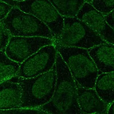 Immunocytochemistry/Immunofluorescence: Integrin beta 6 Antibody [NBP2-14136] - Staining of human cell line RT4 shows localization to nucleoplasm & cell junctions. Antibody staining is shown in green. 