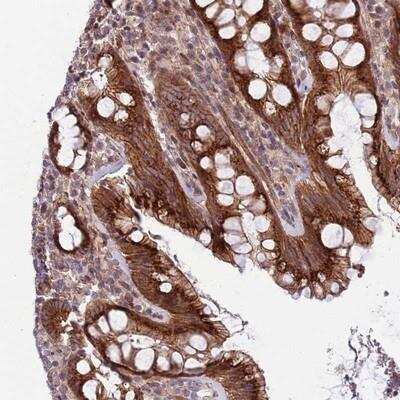 Immunohistochemistry-Paraffin: Integrin beta 6 Antibody [NBP2-14136] - Staining of human rectum shows strong cytoplasmic and membranous positivity in granular pattern in glandular cells.