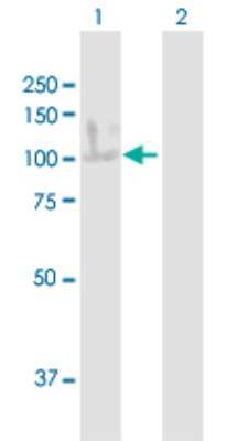 Western Blot: Integrin beta 6 Antibody [H00003694-B01P] - Analysis of ITGB6 expression in transfected 293T cell line by ITGB6 polyclonal antibody.  Lane 1: ITGB6 transfected lysate(86.68 KDa). Lane 2: Non-transfected lysate.