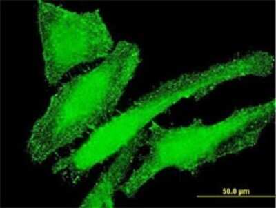 Immunocytochemistry/Immunofluorescence: Integrin beta 7 Antibody (8D3) [H00003695-M01] - Analysis of monoclonal antibody to ITGB7 on HeLa cell . Antibody concentration 10 ug/ml.