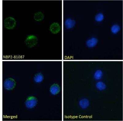 Immunocytochemistry/Immunofluorescence: Integrin beta 7 Antibody (FIB27) [NBP2-81087] - Immunofluorescence staining of fixed human peripheral blood monocytes (PBMs) with Integrin beta 7 Antibody (FIB27) [NBP2-81087]. Immunofluorescence analysis of paraformaldehyde fixed human PBMs on Shi-fix coverslips, permeabilized with 0.15% Triton and stained with the chimeric rabbit IgG version of FIB27 [NBP2-81087] at 10 ug/ml for 1h followed by Alexa Fluor 488 secondary antibody (1 ug/ml), showing memrbane staining. The nuclear stain is DAPI (blue). Panels show from left-right, top-bottom NBP2-81087, DAPI, merged channels and an isotype control. The isotype control was stained with an anti-Fluorescein antibody followed by Alexa Fluor 488 secondary antibody.