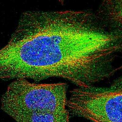 Immunocytochemistry/Immunofluorescence: Integrin beta 7 Antibody [NBP1-87412] - Staining of human cell line U-2 OS shows localization to plasma membrane & cytosol. Antibody staining is shown in green.