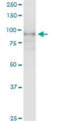 Western Blot: Integrin beta 7 Antibody [H00003695-D01P] - Analysis of ITGB7 expression in human spleen.