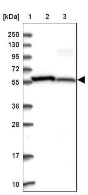 Western Blot: Integrin beta 7 Antibody [NBP1-87412] - Lane 1: Marker [kDa] 250, 130, 95, 72, 55, 36, 28, 17, 10Lane 2: Human cell line RT-4Lane 3: Human cell line U-251MG
