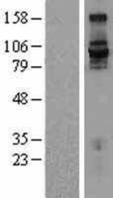 Western Blot: Integrin beta 7 Overexpression Lysate (Adult Normal) [NBL1-12076] Left-Empty vector transfected control cell lysate (HEK293 cell lysate); Right -Over-expression Lysate for Integrin beta 7.