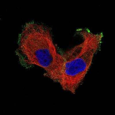 Immunocytochemistry/Immunofluorescence: Integrin beta 8 Antibody (CL7290) [NBP2-76480] - Staining of EFO-21 cells showing specific staining in the plasma membrane. Antibody staining is shown in green.