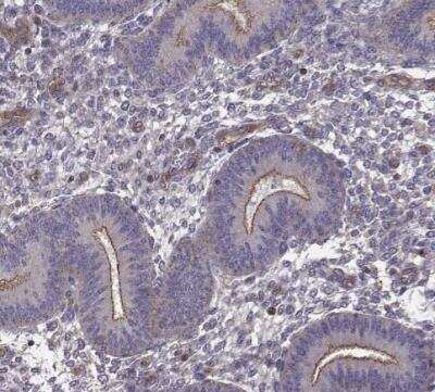 Immunohistochemistry-Paraffin: Integrin beta 8 Antibody [NBP1-87539] - Staining of human endometrium shows strong membranous positivity in glandular cells.