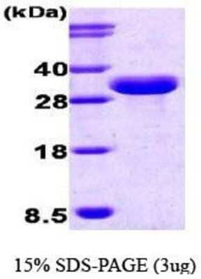 SDS-Page: Recombinant Human ISG15/UCRP Protein [NBC1-18442] -  ISG15, 34kDa (308aa), confirmed by MALDI-TOF with a purity of 98% by SDS - PAGE