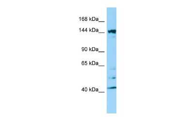 Western Blot: Intersectin 2 Antibody [NBP2-86680] - WB Suggested Anti-ITSN2 Antibody. Titration: 1.0 ug/ml. Positive Control: HepG2 Whole Cell