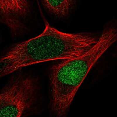 Immunocytochemistry/Immunofluorescence: Intron-Binding Protein Of 160 KDa Antibody [NBP2-55806] - Staining of human cell line U-2 OS shows localization to nucleoplasm.