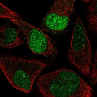 Immunocytochemistry/Immunofluorescence: Intron-Binding Protein Of 160 KDa Antibody [NBP2-57794] - Staining of human cell line RH-30 shows localization to nucleoplasm.