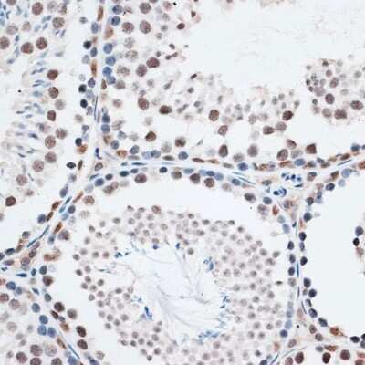 Immunohistochemistry-Paraffin: Intron-Binding Protein Of 160 KDa Antibody [NBP3-03714] - Paraffin-embedded mouse testis using Intron-Binding Protein Of 160 KDa antibody at dilution of 1:100 (40x lens).