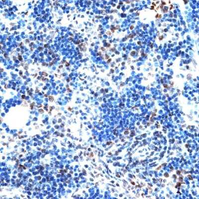 Immunohistochemistry-Paraffin: Intron-Binding Protein Of 160 KDa Antibody [NBP3-03714] - Immunohistochemistry of paraffin-embedded rat spleen using Intron-Binding Protein Of 160 KDa antibody (NBP3-03714) at dilution of 1:100 (40x lens). Perform microwave antigen retrieval with 10 mM PBS buffer pH 7.2 before commencing with IHC staining protocol.