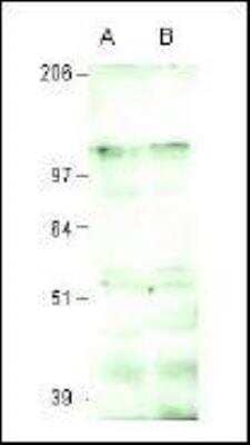 Western Blot: Intron-Binding Protein Of 160 KDa Antibody [NBP2-23607] - Detects an approximately 140 kDa protein in western blot positive control sample and in several mammalian breast cancer cells.