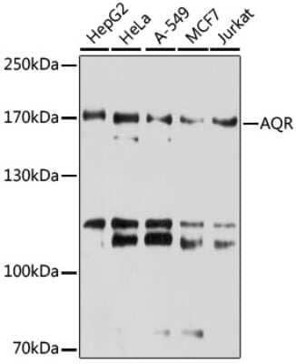 Western Blot: Intron-Binding Protein Of 160 KDa Antibody [NBP3-03714] - Analysis of extracts of various cell lines, using Intron-Binding Protein Of 160 KDa antibody at 1:3000 dilution. Secondary antibody: HRP Goat Anti-Rabbit IgG (H+L) at 1:10000 dilution. Lysates/proteins: 25ug per lane. Blocking buffer: 3% nonfat dry milk in TBST.