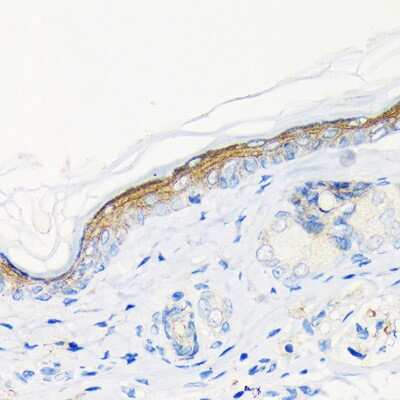 Immunohistochemistry-Paraffin: Involucrin Antibody (8H7B3) [NBP3-15461] - Rat skin using Involucrin Rabbit mAb (NBP3-15461) at dilution of 1:100 (40x lens).Perform microwave antigen retrieval with 10 mM Tris/EDTA buffer pH 9.0 before commencing with IHC staining protocol.