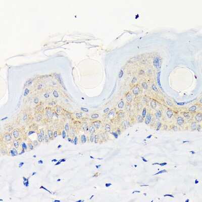 Immunohistochemistry-Paraffin: Involucrin Antibody (8H7B3) [NBP3-15461] - Mouse skin using Involucrin Rabbit mAb (NBP3-15461) at dilution of 1:100 (40x lens).Perform microwave antigen retrieval with 10 mM Tris/EDTA buffer pH 9.0 before commencing with IHC staining protocol.