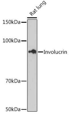 Western Blot: Involucrin Antibody (8H7B3) [NBP3-15461] - Analysis of extracts of Rat lung cells, using Involucrin antibody (NBP3-15461) at 1:500 dilution. Secondary antibody: HRP Goat Anti-Rabbit IgG (H+L) at 1:10000 dilution. Lysates/proteins: 25ug per lane. Blocking buffer: 3% nonfat dry milk in TBST. Detection: ECL Basic Kit. Exposure time: 180s.