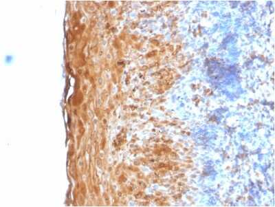 Immunohistochemistry-Paraffin: Involucrin Antibody (IVRN/2113R) - Azide and BSA Free [NBP3-08386] - Formalin-fixed, paraffin-embedded human Tonsil stained with Involucrin Rabbit Recombinant Monoclonal Antibody (IVRN/2113R).