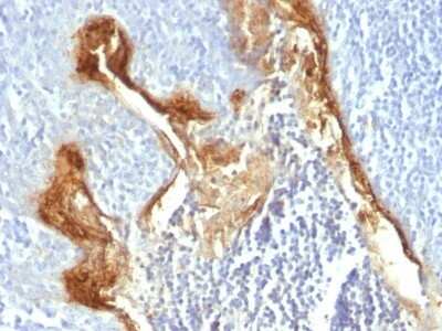 Immunohistochemistry-Paraffin: Involucrin Antibody (IVRN/827) [NBP2-44883] - Human Tonsil stained with Involucrin Monoclonal Antibody (IVRN/827)