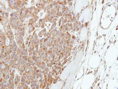 Immunohistochemistry-Paraffin: Involucrin Antibody [NBP2-16981] - Immunohistochemical analysis of paraffin-embedded H661 xenograft, using antibody at 1:250 dilution.