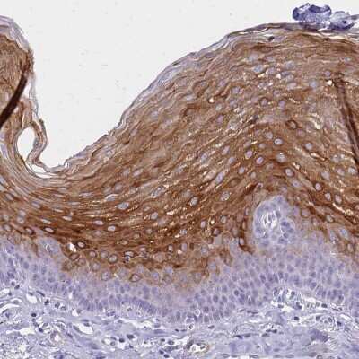 Immunohistochemistry-Paraffin: Involucrin Antibody [NBP2-33742] - Staining of human esophagus shows moderate to strong cytoplasmic positivity in squamous epithelial cells.