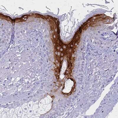 Immunohistochemistry-Paraffin: Involucrin Antibody [NBP2-33742] - Staining of human skin shows moderate to strong cytoplasmic positivity in keratinocytes.