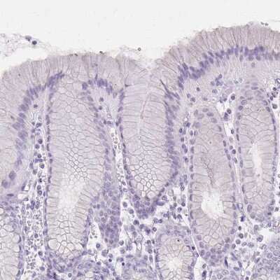 Immunohistochemistry-Paraffin: Involucrin Antibody [NBP2-33742] - Staining of human stomach shows no cytoplasmic positivity in glandular cells as expected.