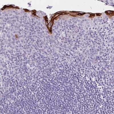 Immunohistochemistry-Paraffin: Involucrin Antibody [NBP2-33742] - Staining of human tonsil shows moderate to strong cytoplasmic positivity in squamous epithelial cells.