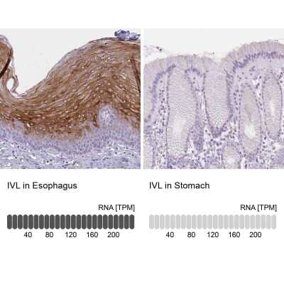 Immunohistochemistry-Paraffin: Involucrin Antibody [NBP2-33742] - Staining in human esophagus and stomach tissues. Corresponding IVL RNA-seq data are presented for the same tissues.