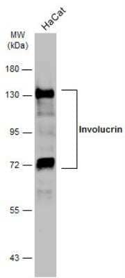 Western Blot: Involucrin Antibody [NBP2-16981] - Whole cell extract (30 ug) was separated by 7.5% SDS-PAGE, and the membrane was blotted with Involucrin antibody [N1N2], N-term diluted at 1:5000. The HRP-conjugated anti-rabbit IgG antibody (NBP2-19301) was used to detect the primary antibody.