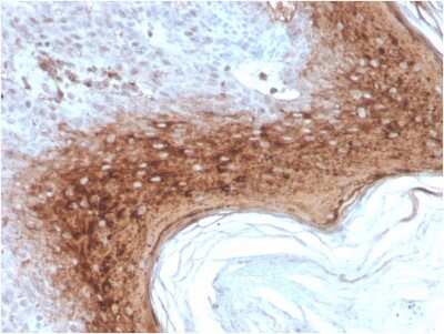 Immunohistochemistry-Paraffin: Involucrin Antibody (rIVRN/827) - Azide and BSA Free [NBP3-08292] - Formalin-fixed, paraffin-embedded human Skin stained with Involucrin Mouse Recombinant Monoclonal Antibody (rIVRN/827).