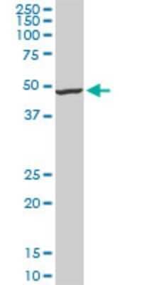 Western Blot Iroquois-class homeodomain protein IRX-5 Antibody (6A9) - Azide and BSA Free
