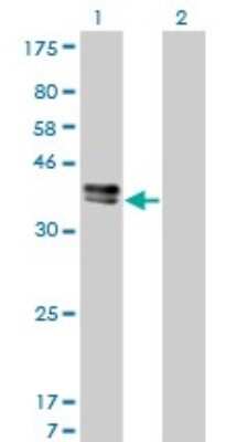 Western Blot: Islet-1 Antibody (1A3) [H00003670-M01] - Analysis of ISL1 expression in transfected 293T cell line by ISL1 monoclonal antibody (M01), clone 1A3.Lane 1: ISL1 transfected lysate(38.7 KDa).Lane 2: Non-transfected lysate.